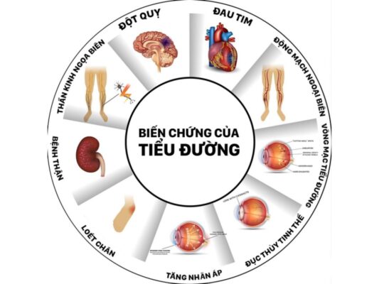 biến chứng tiểu đường