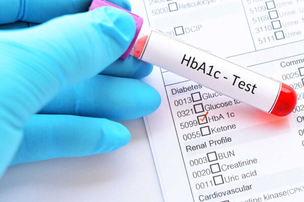 xét nghiệm tiểu đường - HbA1c