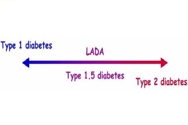 Thế nào là đái tháo đường typ 1.5