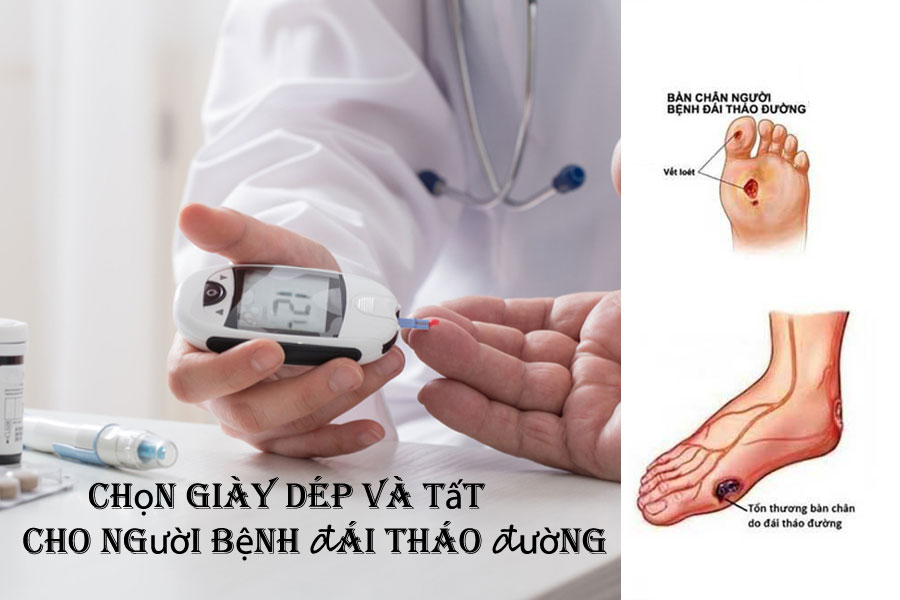 Cách chọn giày dép ở người bệnh đái tháo đường.